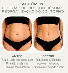 Antes e depois Crio — Abdómen