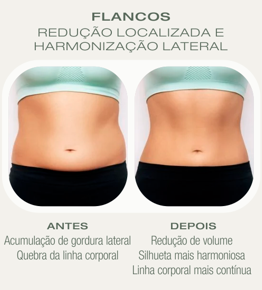 Antes e depois Crio — Flancos