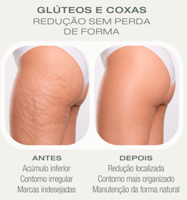 Antes e depois Crio — Glúteos e Coxas