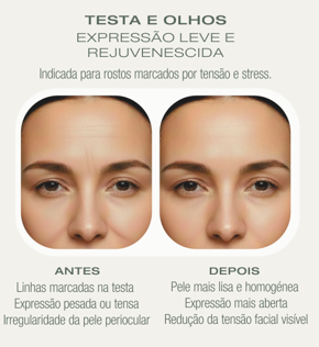Testa e Olhos — Antes e Depois Microagulhamento