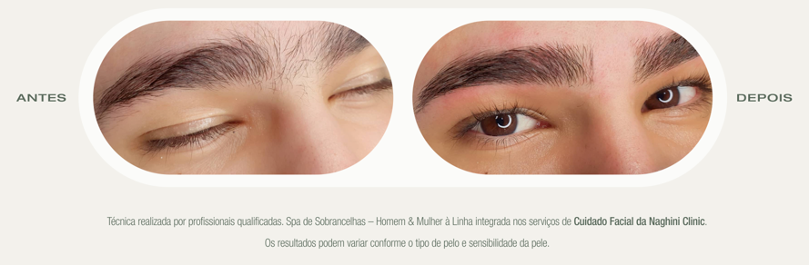 Antes e Depois — Spa de Sobrancelhas Homem & Mulher — Naghini Clinic